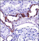 MCOLN1 Antibody (C-term)
